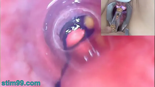 New Mature Woman Peehole Endoscope Camera in Bladder with Balls cool Clips